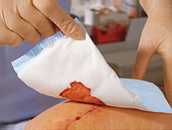 Pensos-Pos-Operatorio-Nao-Esterilizados-Zetuvit-E