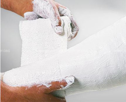 Ligadura-de-Gaze-Revestida-em-Gesso-Safix-Plus--2-Unidades-