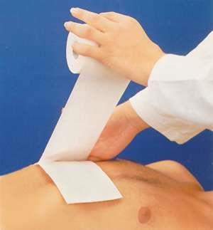 Adesivo-Hipoalergenico-Eurofix-10-m-x-15-cm