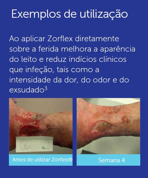 ZORFLEX-Penso-Tecido-com-Carvao-Ativado