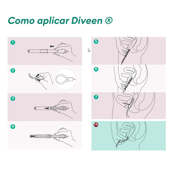 Dispositivo-para-Incontinencia-Urinaria-Feminina-Diveen-2
