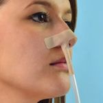 Adesivo-Nasal-para-Fixacao-de-Cateter-Elastonasal-