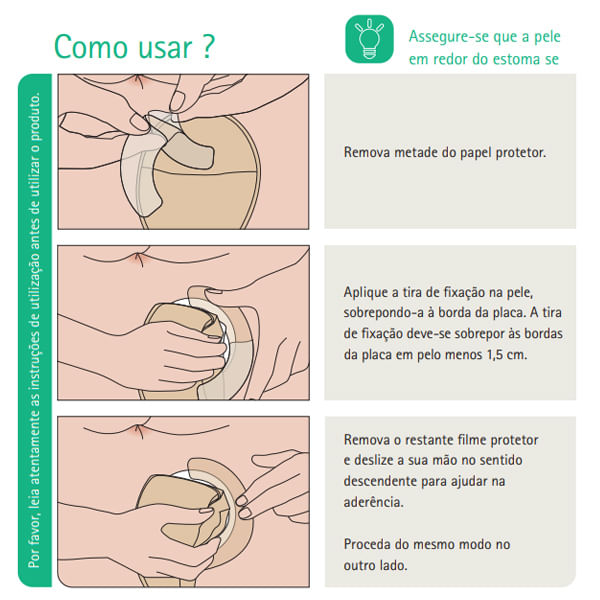 Tiras-de-Fixacao-Ally-2.jpg
